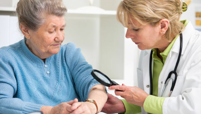 Critical silent signs of skin cancer